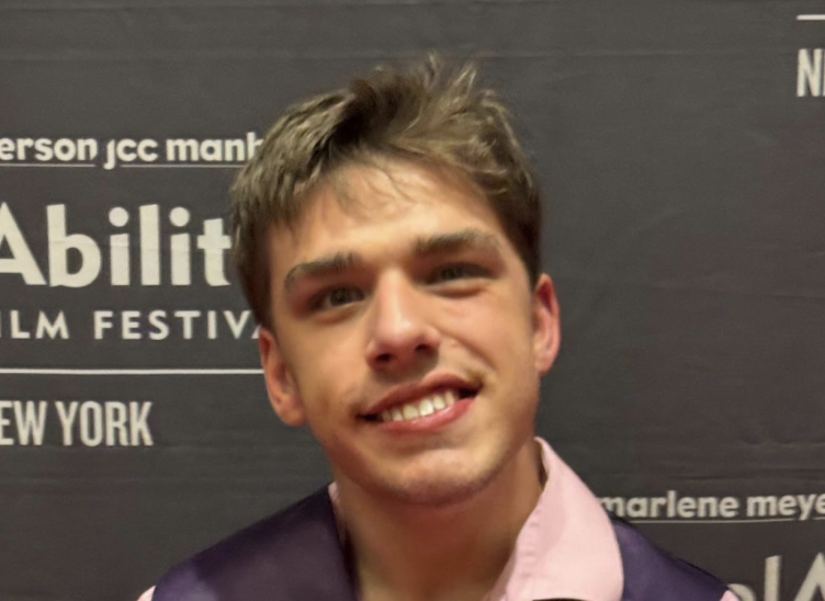 More Than a TikTok Star: Toby Smiles’ Journey of Strength and Self-acceptance